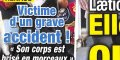 Renaud souffre après son accident, son corps est brisé en morceaux (photo)