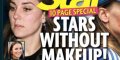 « Sans maquillage », Kate Middelton affiche sa mystérieuse cicatrice (photo)