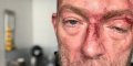 Vincent Cassel visage en sang, la photo choc !