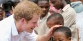 Touché par la calvitie, le prince Harry se fera greffer des implants pour 56000 euros
