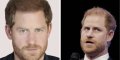 Prince Harry : fini la calvitie, une nouvelle chevelure fait sensation