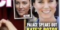 Prince William, scandale, le botox de Kate Middleton choque (photo)