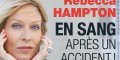 Rebecca Hampton, en sang après un accident (photo)