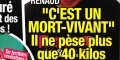 Renaud, « un mort vivant », il ne pèse plus que 40 kilos (photo)