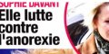 Sophie Davant, troubles alimentaires, la vérité éclate (photo)