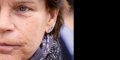 Stéphanie de Monaco : Trouble neurologique, diagnostiquée trop tard !