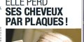 Sylvie Tellier sous pression, elle perd ses cheveux par plaques (photo)