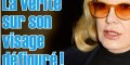 Sylvie Vartan, la vérité sur son visage défiguré