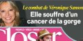 Véronique Sanson atteinte d'un cancer de la gorge