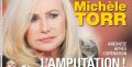 Michèle Torr, « l'amputation »