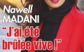 Nawell Madani, le choc, "J'ai été brûlée vive"