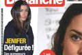 Jenifer agressée et défigurée prétend France Dimanche