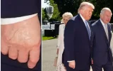 Donald Trump : ce détail physique sur sa main qui a choqué le roi Charles III
