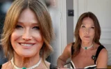 « Fini le Botox ! » : Carla Bruni s'exprime sur les rumeurs de chirurgie esthétique
