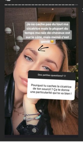 emma-smet-cette-cicatrice-quelle-cache-livre-enfin-sa-verite