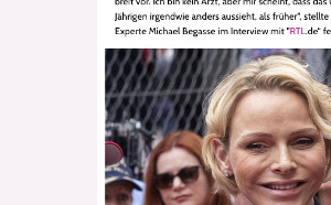 charlene-de-monaco-le-choc-le-botox-quest-il-arrive-a-son-visage
