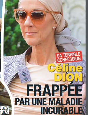 celine-dion-frappee-maladie-incurable-degenerescence-maculaire
