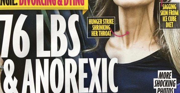 Angelina Jolie, vraiment anorexique et proche de la mort ?