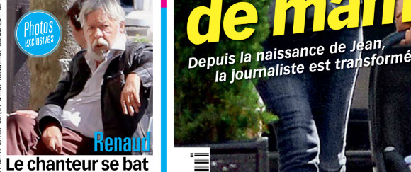 Renaud victime d'une paralysie partielle du visage