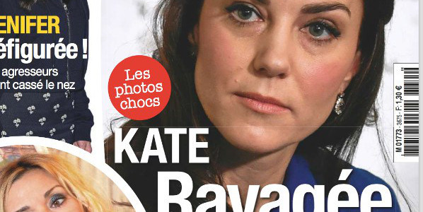 Kate Middleton ravagée par une grave maladie, une blessure qui inquiète (photo)