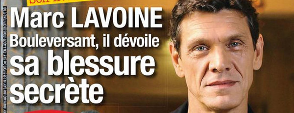 Marc Lavoine, des troublantes révélations sur sa sexualité