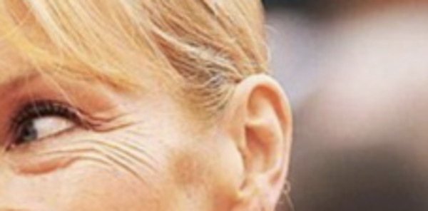 Estelle Lefébure, ridules marquées, perte de fermeté, cet abus qui lui gâche la vie (photo)