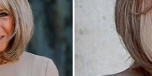 Brigitte Macron, luxation d'épaule, explication troublante qui fait jaser