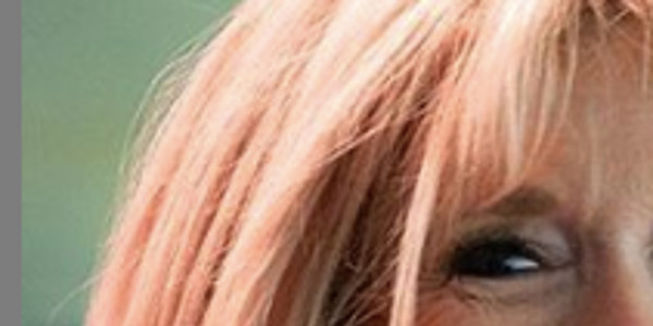 Brigitte Macron, opération esthétique, insultes récurrentes, étonnante révélation