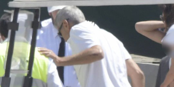 George Clooney en piteux état après avoir été percuté par une voiture