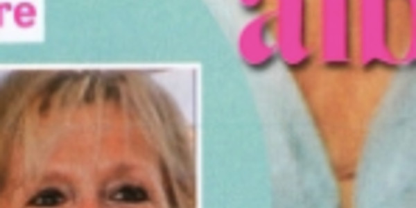 Brigitte Macron, sourire rectifié, physique changé, étonnante photo