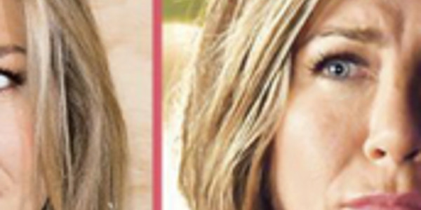 Jennifer Aniston, « visage déformé », désagréable raté chirurgical (photo)