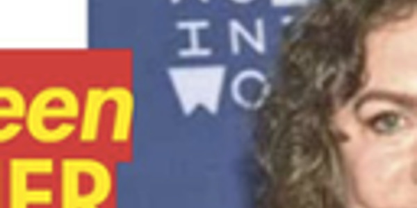 Kathleen Turner, visage figé et ravagé, elle fait peine à voir (photo)
