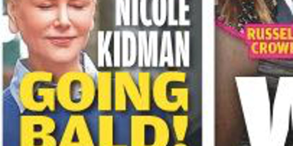 Nicole Kidman devient chauve, la vérité implacable, (photo)