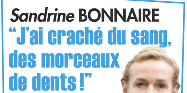 Sandrine Bonnaire, drame, « J'ai craché du sang, des morceaux de dents »