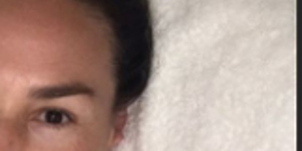 Vanessa Demouy rajeunie et repulpée, son étonnant secret (photo)