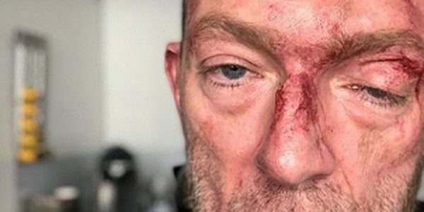 Vincent Cassel visage en sang, la photo choc !