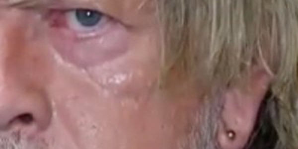 Renaud, rechute, dépression, silence trouble de Romane Serda