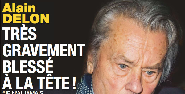 Alain Delon très gravement blessé à la tête (photo)