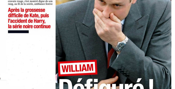 Kate Middleton- William défiguré selon France Dimanche