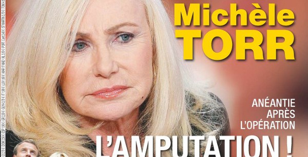 Michèle Torr brise le silence sur l'amputation de son mari