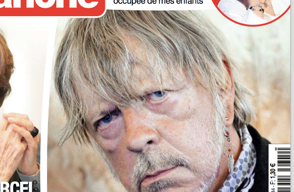 Renaud - Un déséquilibré menace sa fille avec une arme ? selon France Dimanche