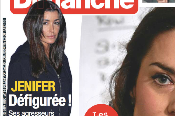 Jenifer agressée et défigurée prétend France Dimanche