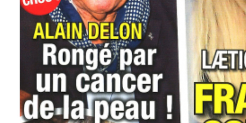 Alain Delon "isolé" dans le Loiret - Cancer de la peau - Implacable mise au point (photo)