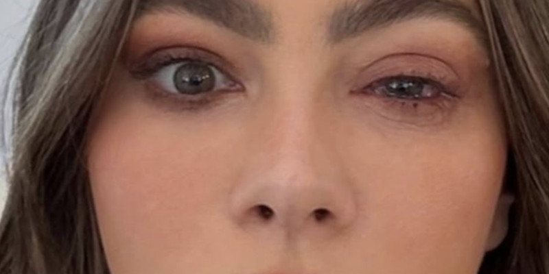 Une allergie soudaine prive Sofía Vergara des Emmys