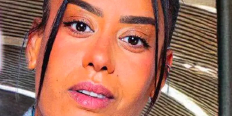 Amel Bent brûlée au 3e degré