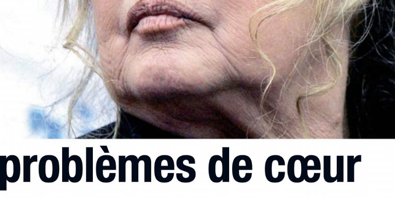 Brigitte Bardot, de graves problèmes de cœur