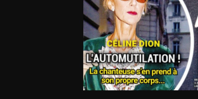Céline Dion, l'automutilation - elle s'en prend à son propre corps, la vérité enfin (photo)