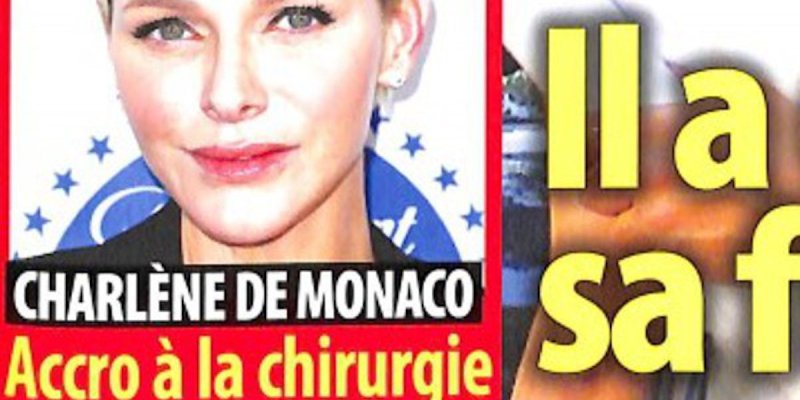 Charlène de Monaco, abus de chirurgie, flippante mise en garde de Linda Evangelista défigurée