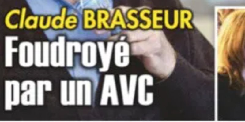 Claude Brasseur décédé - Une grave pathologie cardiovasculaire