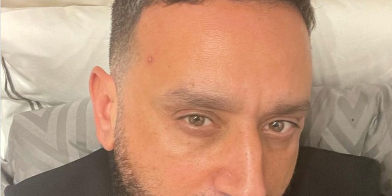 Cyril Hanouna, son visage défiguré par des boutons, Eric Zemmour lui remonte le moral